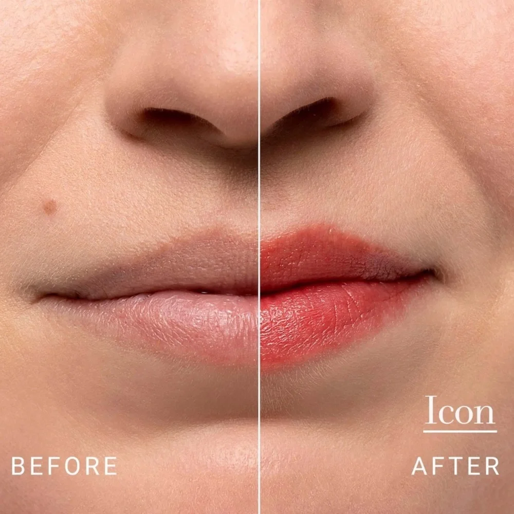 🍓 FRESH Sugar Lip Treatment Balm - Icon